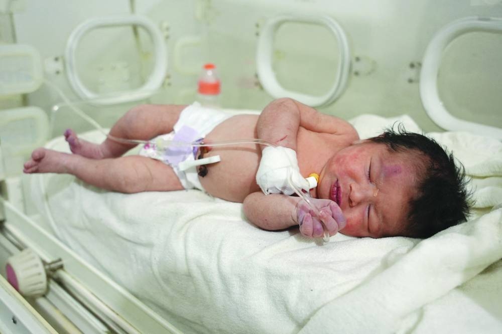 A newborn baby who was found still tied by her umbilical cord to her mother and pulled alive from the rubble of a home in northern Syria receives medical care at a clinic in Afrin, yesterday. The infant is the sole survivor of her immediate family, the rest of whom were all killed when a 7.8-magnitude quake that struck Syria and neighbouring Turkiye flattened the family home in the rebel-held town of Jindayris, cousin Khalil al-Suwadi said. (AFP)