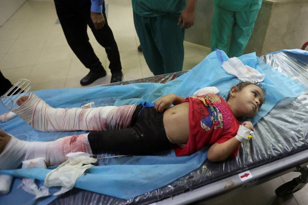 A Palestinian girl, wounded in Israeli strikes, lies on a bed at a hospital in Khan Younis in the southern Gaza strip,  Monday. REUTERS