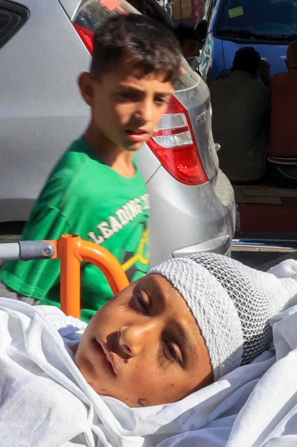 A Palestinian child injured during an Israeli air strike waits for treatment outside the Nasser hospital in Khan Yunis on the southern Gaza Strip on Tuesday. AFP