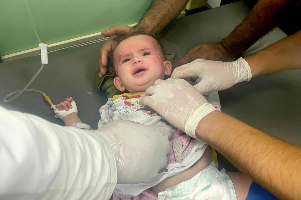 Trauma surgeons attend to an infant injured after Israeli bombardment, at the Kuwaiti hospital in Rafah in the southern Gaza Strip on Saturday. AFP
