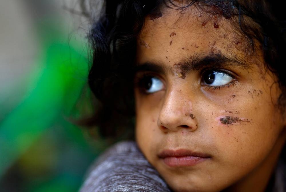 A Palestinian girl, one of the few survivors of Allamdani family, who fled to southern Gaza Strip to avoid the constant onslaught of Israeli airstrikes in Gaza City and settled in a shelter which was later hit by Israeli jets that killed 13 of her relatives, looks on, in Khan Younis in the southern Gaza Strip, on Monday. REUTERS