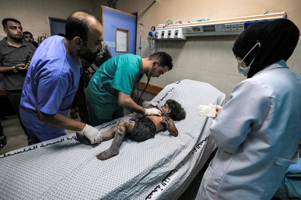 A physician checks on a child who was injured in Israeli bombardment at a trauma ward at Nasser hospital in Khan Yunis in the southern Gaza Strip on Tuesday. AFP