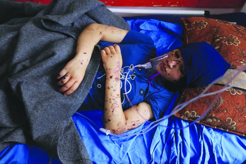 
Thirteen year-old amputee Layan al-Baz receives treatment at the Nasser hospital in Khan Yunis in the southern Gaza Strip. 