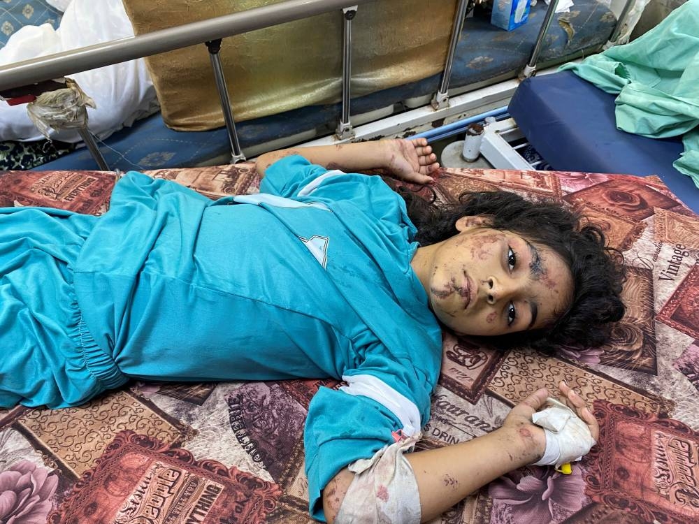 A girl wounded in Israeli strikes rests at Al Shifa hospital in Gaza City, Wednesday. REUTERS