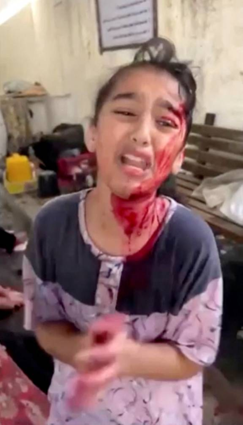 A Palestinian girl with face stained with blood cries at the outpatient clinic of Al Shifa Hospital, following an Israeli strike, in Gaza City, on Friday. Ahmed Hejazi/Instagram/via REUTERS