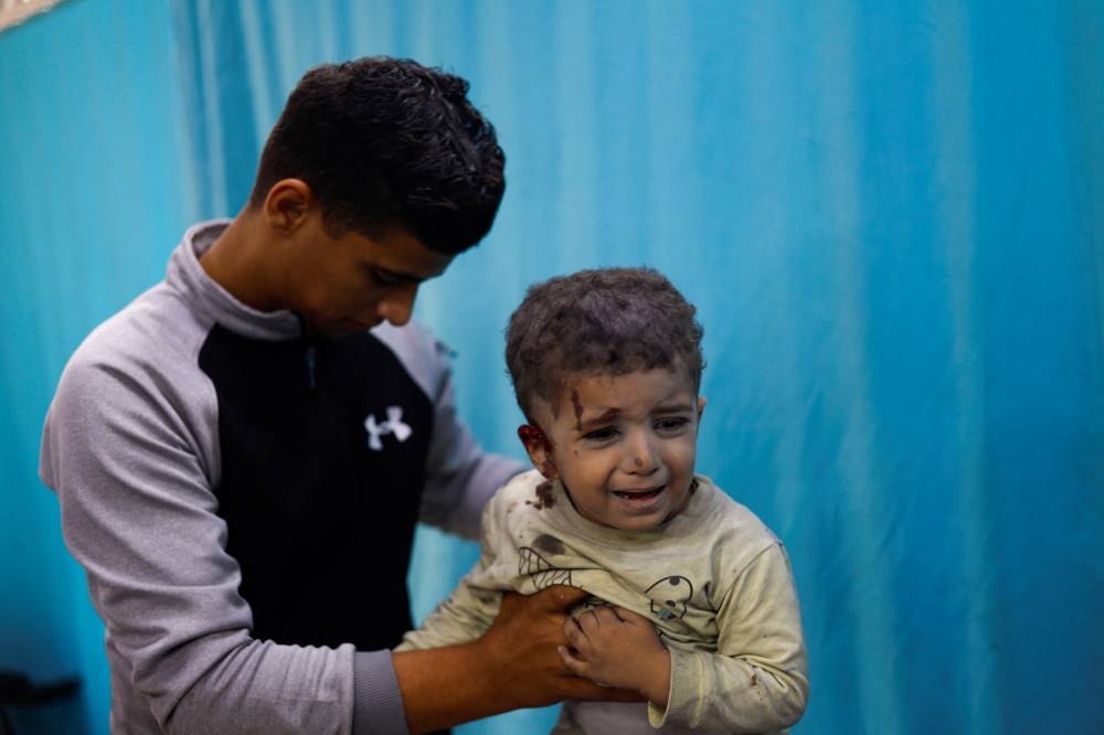 A Palestinian child wounded in Israeli strikes waits to receive treatment at Nasser hospital in Khan Younis in the southern Gaza Strip, on Sunday. REUTERS