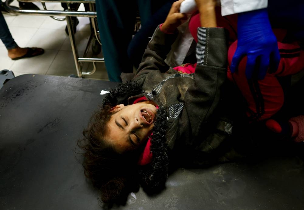 A Palestinian child wounded in an Israeli strike is assisted at Nasser hospital in Khan Younis in the southern Gaza Strip, on Monday. REUTERS