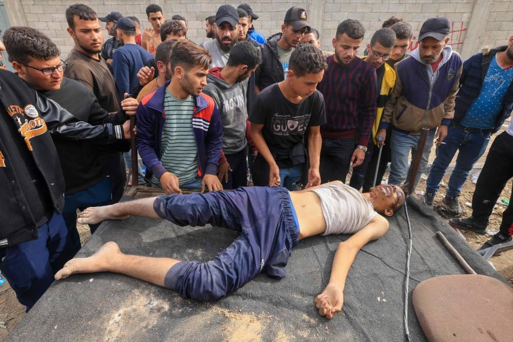 A Palestinian man who was hurt while leaving a hospital in Gaza City is placed on a cart as people leave the north through the Zeitoun district as Palestinians leave the north, on Saturday. AFP