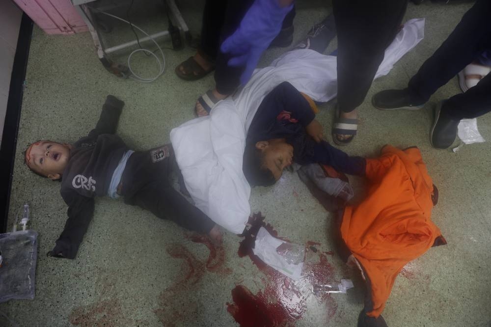 Wounded Palestinian children are assisted at Nasser hospital, following Israeli strikes on Ma'an school east of Khan Younis, on Tuesday. REUTERS