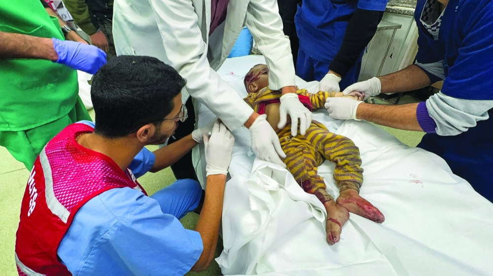 Medical professionals treat a Palestinian child wounded in Israeli strikes at Nasser hospital in Khan Younis in the southern Gaza Strip yesterday.