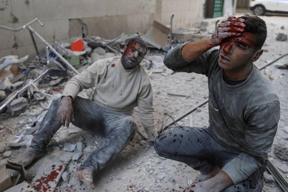 Wounded Palestinians react at the site of an Israeli strike in Khan Younis, amid the ongoing conflict between Israel and the Palestinian Islamist group Hamas, in the southern Gaza Strip on October 19. REUTERS