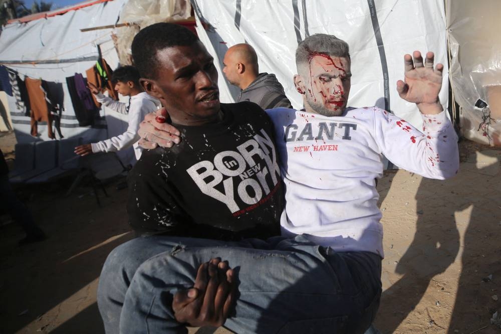 A wounded Palestinian is transported for treatment to the al-Aqsa Hospital after an Israeli strike on a house in Deir el-Balah in the central Gaza Strip, on Wednesday. AFP