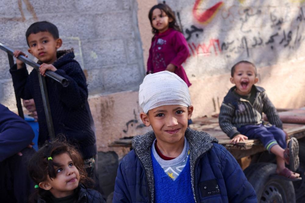 Mysara Abu Telakh, a displaced Palestinian boy who was wounded in an Israeli strike, looks on in Rafah in the southern Gaza Strip, on Monday. REUTERS