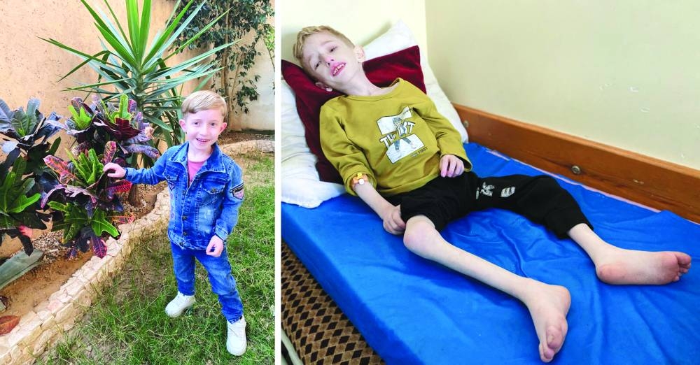 A combination picture shows Palestinian boy Fadi al-Zant looking on before suffering from malnutrition in an undated handout photo (L) and al-Zant lying on a bed after being malnourished at Kamal Adwan hospital.