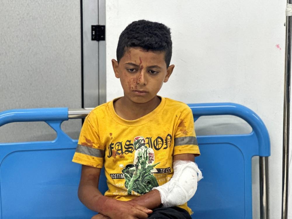 A Palestinian child, wounded in an Israeli strike on an area designated for displaced people, sits at a hospital, in Rafah in the southern Gaza Strip, on Sunday. REUTERS