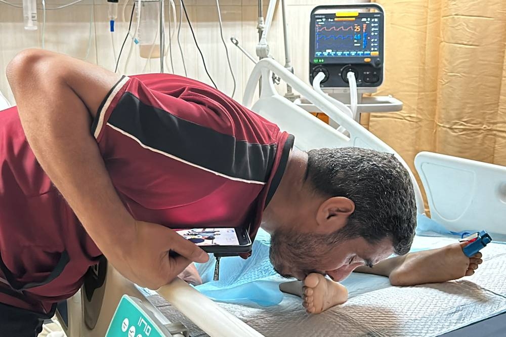 A father kisses his injured child's, Tawfik Abu Youssef, foot as he lies in bed, in Al-Aqsa Martyrs Hospital, in the aftermath of an Israeli strike, in Deir Al-Balah, in the central Gaza Strip, on Sunday. REUTERS