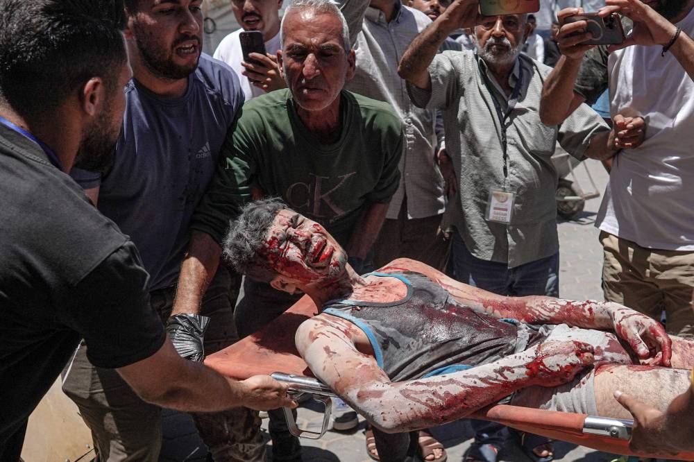 An injured youth is brought to the Al-Aqsa Martyrs Hospital in Deir al-Balah, after the Israeli bombardment of agricultural land in the area of al-Maghazi in the central Gaza Strip on Tuesday. AFP