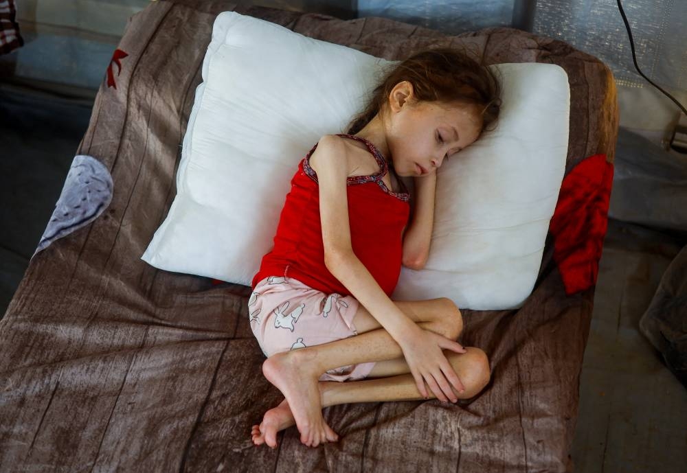 Jana Ayad, a malnourished Palestinian girl, rests on a bed as she receives treatment at the International Medical Corps field hospital in Deir Al-Balah in the southern Gaza Strip, on Saturday. REUTERS