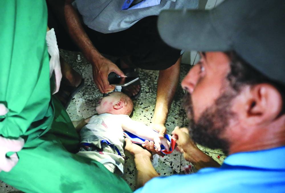 
Palestinian children wounded in Israeli strikes receive treatment at a hospital in Gaza City. 