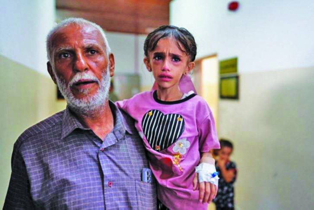 
A severely malnourished child being carried by her kin. 