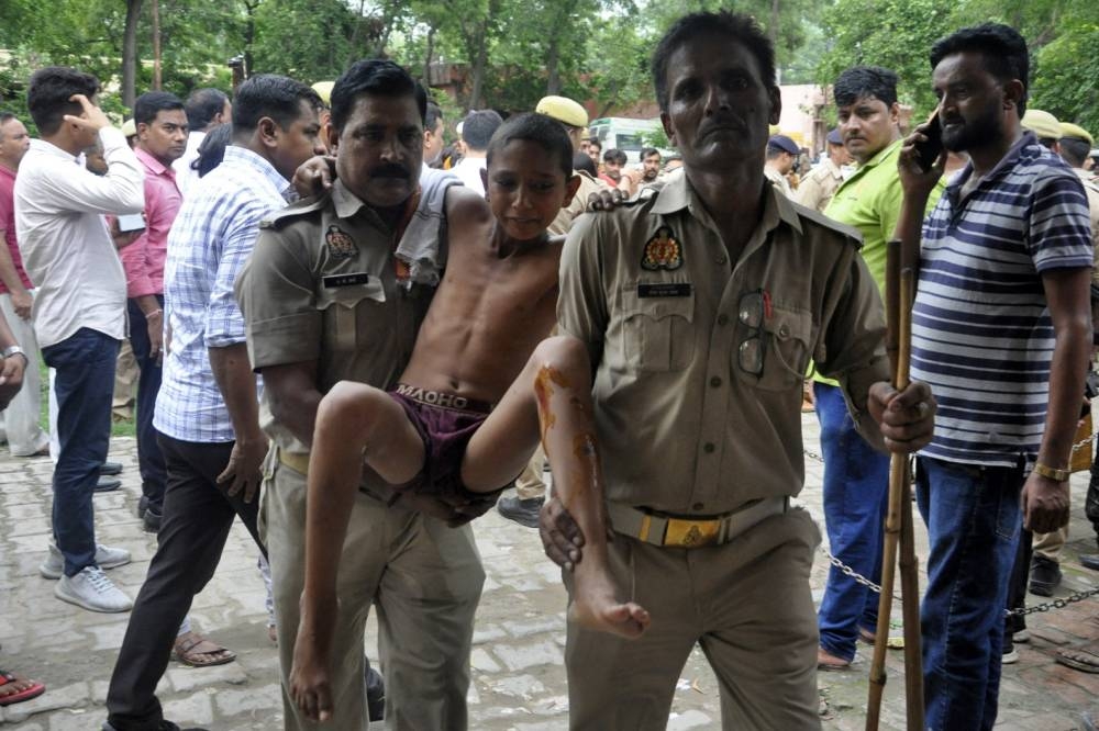 A boy, who was injured in a stampede at a religious gathering, reacts as he is brought to a hospital for a treatment in Hathras, Tuesday. REUTERS