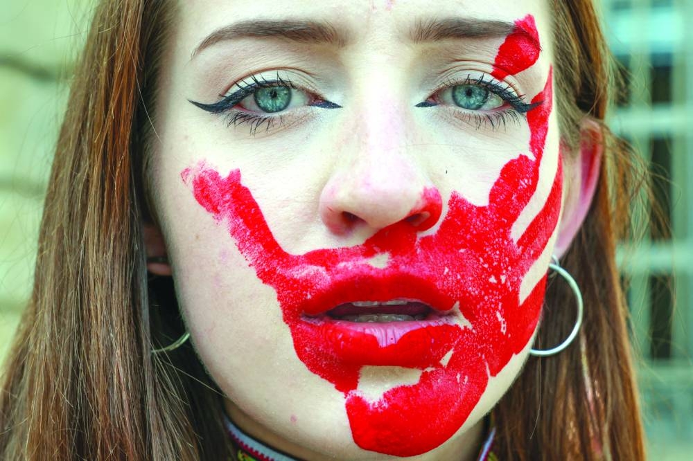 Olha has a bloody hand printed on her face as Ukrainians in Paris rally in memory of athletes they say have been killed during the war in Ukraine, two weeks before the start of the Paris 2024 Olympics and Paralympics Games in Paris. (Reuters) 