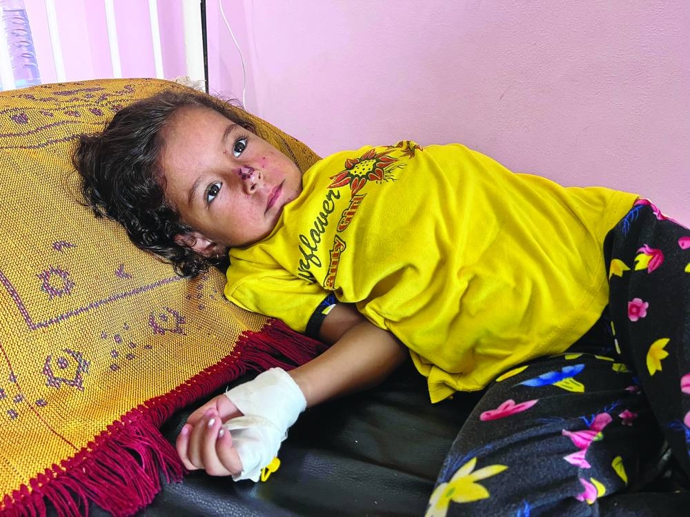 A Palestinian girl with a skin disease lies on a bed as she receives treatment at Nasser hospital, amid Israel-Hamas conflict, in Khan Younis in the southern Gaza Strip July 29, 2024. REUTERS/Hussam Al-Masri