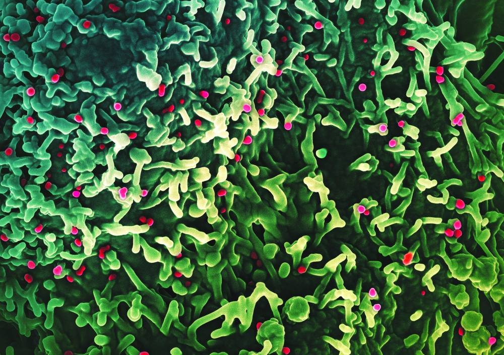 An undated colourised scanning electron micrograph of mpox virus (red) on the surface of infected VERO E6 cells (green), captured at the National Institute of Allergy and Infectious Diseases (NIAID) Integrated Research Facility (IRF) in Fort Detrick, Maryland. – Reuters 