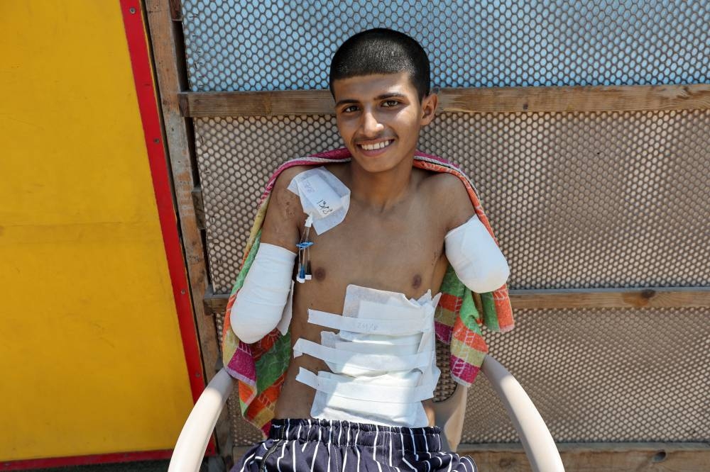 Palestinian teenager Diaa Al-Adini, who had his both arms amputated after being wounded in an Israeli strike on August 13 and was transferred from Al-Aqsa hospital due to an Israeli evacuation oder, looks on as he sits on a beach outside a field hospital, in Deir Al-Balah in the central Gaza Strip, on Tuesday. REUTERS