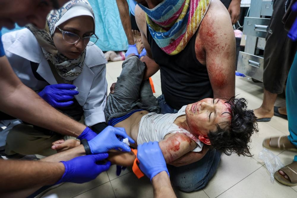 Medics treat a Palestinian boy, who was wounded in an Israeli strike at Al-Aqsa Martyrs Hospital in Deir Al-Balah in the central Gaza Strip, on Monday. REUTERS