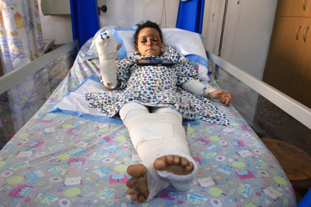 Wounded Lebanese child Haidar Hijazi, 5, rests at hospital in Sidon on Friday, after he was injured following an Israeli airstrike that targeted his home village of al-Sharkiyah in southern Lebanon. AFP