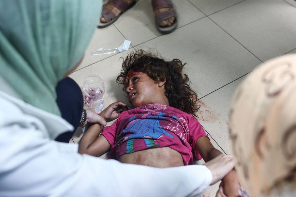 Palestinian medics treat a girl who was injured in Israeli strikes on a displacement camp in the Bureij refugee camp, at the al-Aqsa Martyrs hospital in Deir al-Balah in the central Gaza Strip on Tuesday. AFP