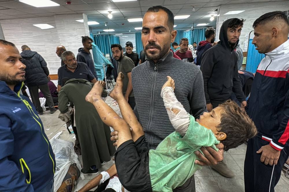  Palestinian carries a child injured in Israeli bombardment of the Beit Lahia Project into the Kamal Adwan Hospital in Beit Lahia in the northern Gaza Strip on Wednesday. AFP