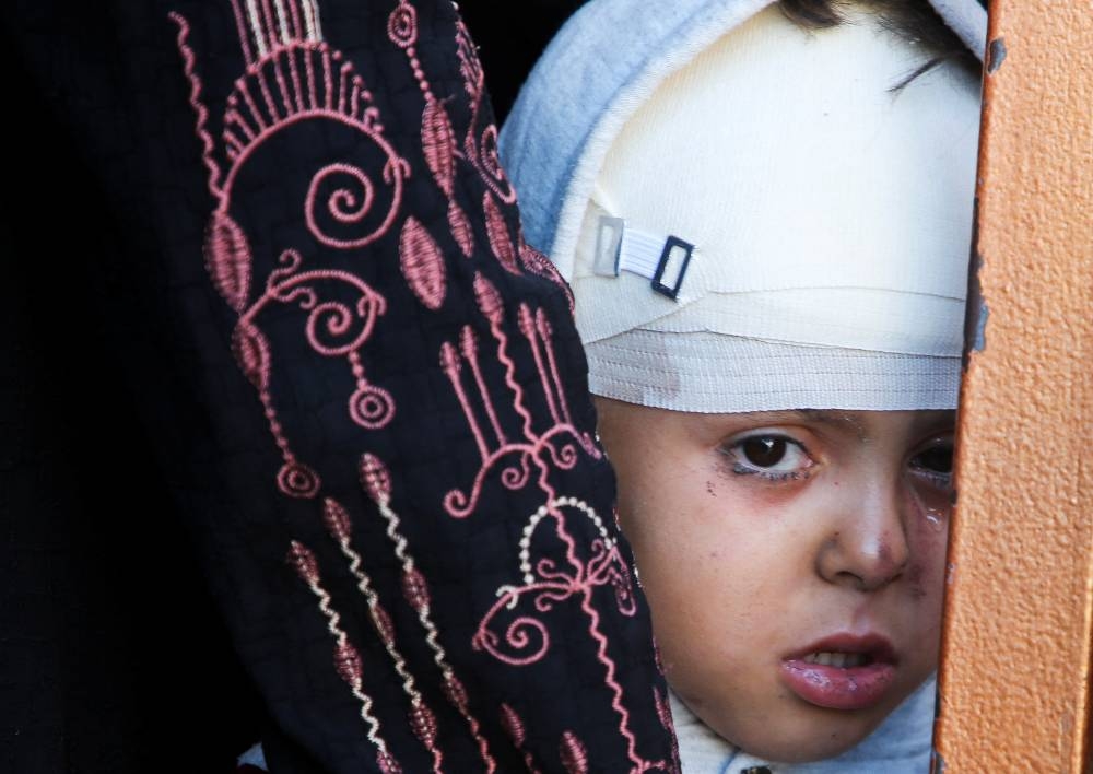 A Palestinian boy who was wounded during an Israeli strike looks on in the aftermath of the strike, in Khan Younis in the southern Gaza Strip, on Wednesday. REUTERS