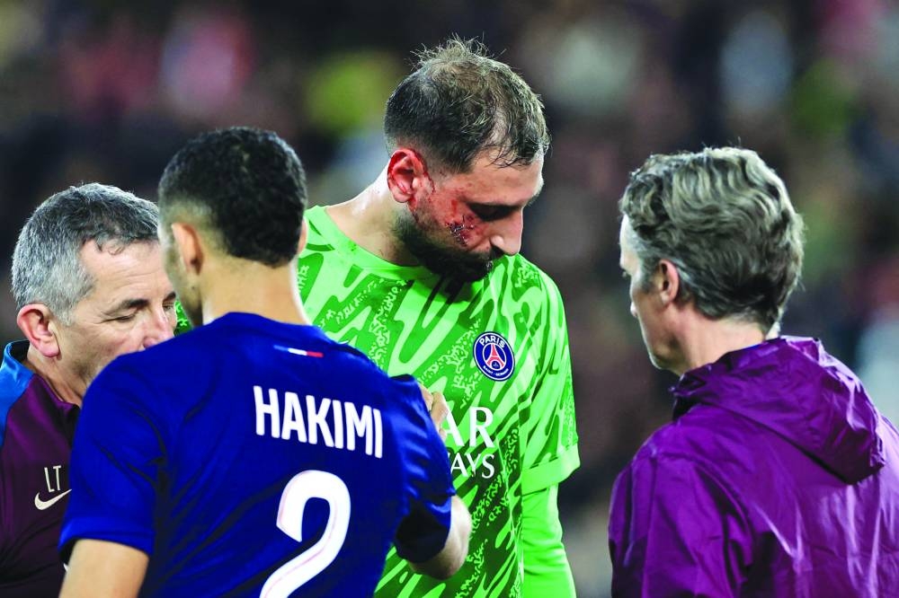 Paris Saint-Germain’s Italian goalkeeper Gianluigi Donnarumma receives medical help after sustaining an injury during the French L1 match against AS Monaco at the Louis II Stadium in Monaco on Thursday. (AFP)