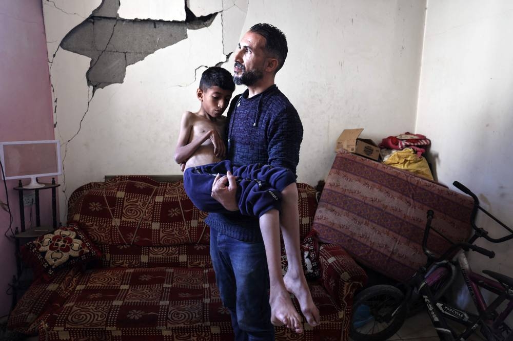 Mohammed Hanieh, a 13-year-old Palestinian boy who suffers from malnutrition, is carried by his father in the Bureij refugee camp in the central Gaza Strip on Saturday 