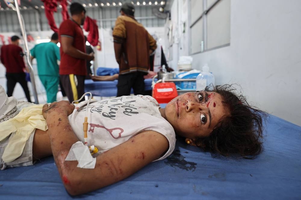 A wounded girl receives treatment at Al-Awda Hospital at the Nuseirat refugee camp in the central Gaza Strip, following an Israeli airstrike that hit a school in the camp on Monday. AFP