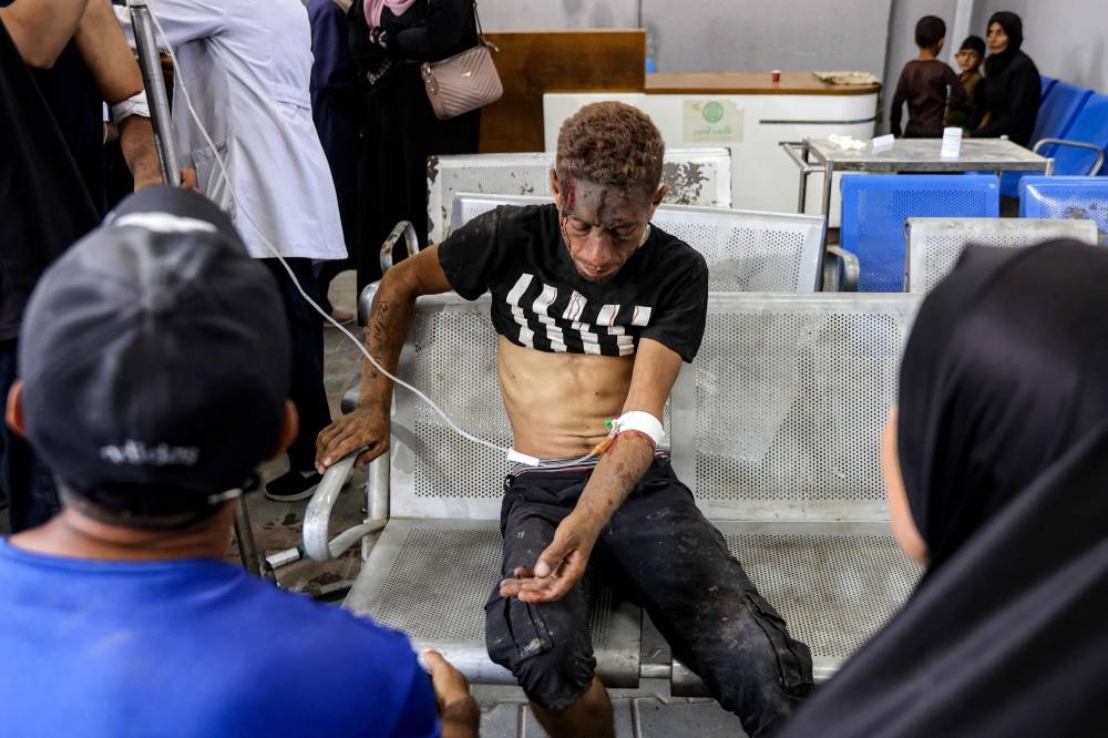An injured man sits with an intravenous (IV) line injected into his arm at Al-Shifa hospital in Gaza City on Saturday following reported Israeli attacks on aid queues in the Sudaniya area in northwestern Gaza. AFP
