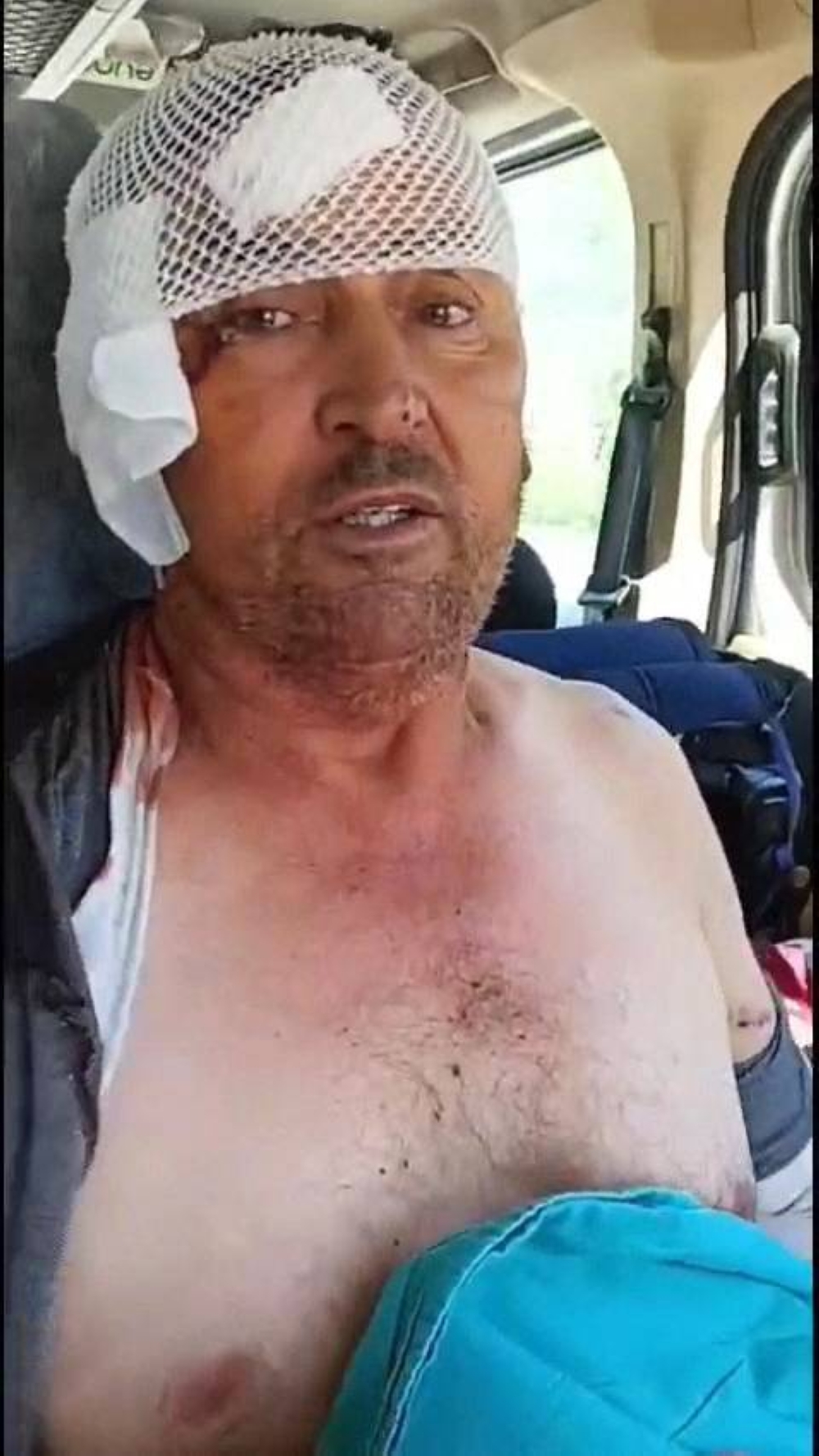 Suleyman Kir who was attacked by a lion that escaped from the zoo in Antalya. AFP/DHA