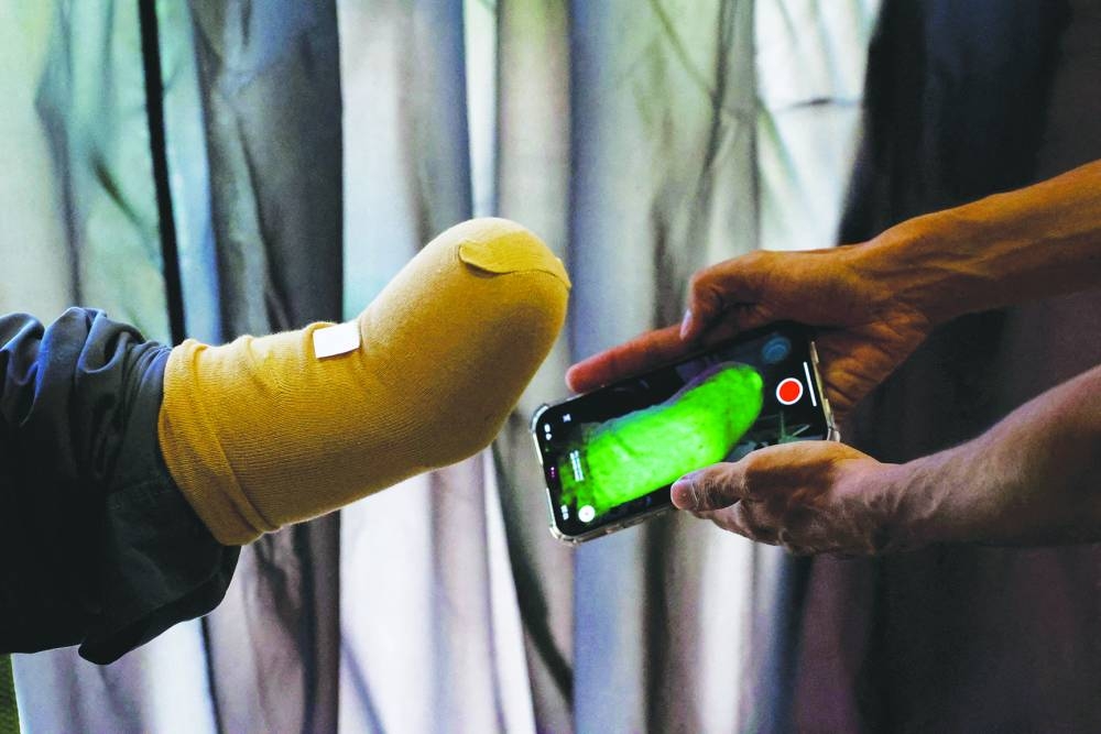 
A technician uses a mobile phone for 3D scan of a patient before developing a prosthetic limb at the Bioniks Private Limited. (Reuters) 