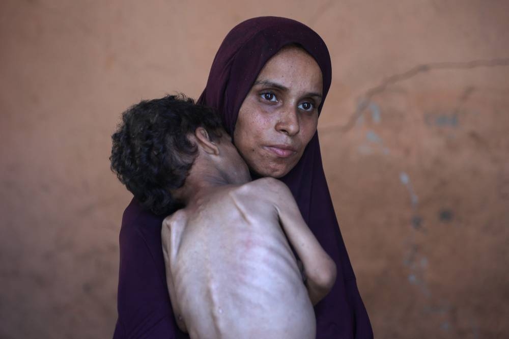 Naeema, a 30-year-old Palestinian mother, carries her malnourished 2-year-old son Yazan as they stand in their damaged home in the Al-Shati refugee camp, west of Gaza City, yesterday.