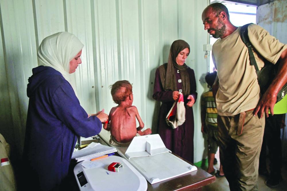 
A malnourished Palestinian child gets a check up at a medical point run by a local NGO affiliated with the primary healthcare of the Palestinian health ministry in Al-Mawasi, in the southern Gaza Strip district of Khan Yunis. 