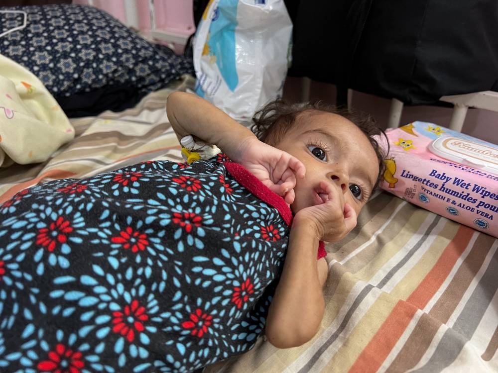 Reseel Abu Masoud, a two-month-old girl who is malnourished, according to doctors, lies at Nasser Hospital, in Khan Younis, southern Gaza Strip, on Thursday. REUTERS