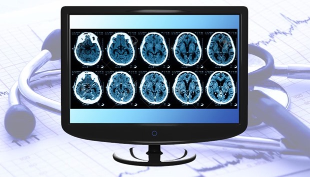 The telemedicine technology enables direct evaluation of stroke patients admitted at Al Khoru2019s Emergency Department and allows real time examination of the CT scan imagery by HMCu2019s expert stroke team based at HGHu2019s Stroke Ward in Doha