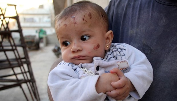 Syrian Yehya Maatouq holds his four-month-old daughter Wahida