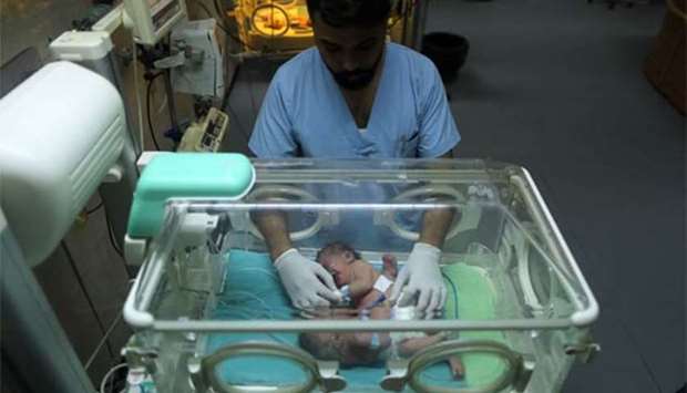 One-day-old Palestinian conjoined twins lie in an incubator at the nursery at al-Shifa Hospital in Gaza City on Sunday.