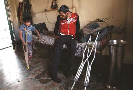 A Syrian father and his son who suffer from severe leg injuries following shelling in the rebel held areas around Damascus, are seen in their house in the Eastern Ghouta town of Hamouria, yesterday.