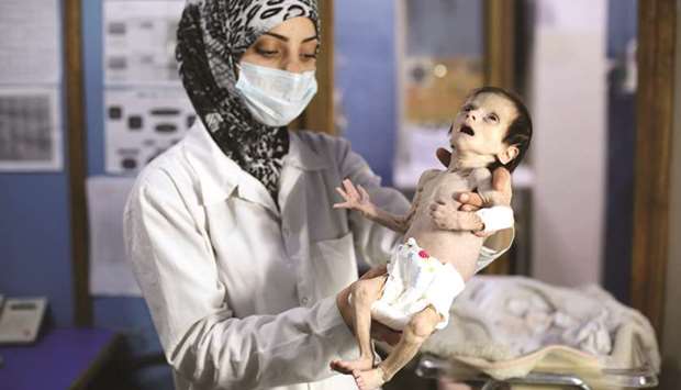 A Syrian infant suffering from severe malnutrition is carried by a nurse at a clinic in the rebel-controlled town of Hamouria, in the eastern Ghouta region.