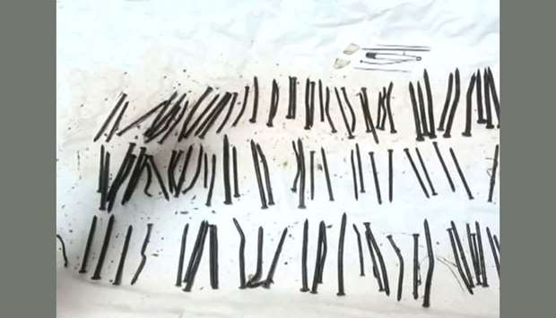 The nails and other sharp objects extracted from the patient's stomach. Photo courtesy: SonDakika.com
