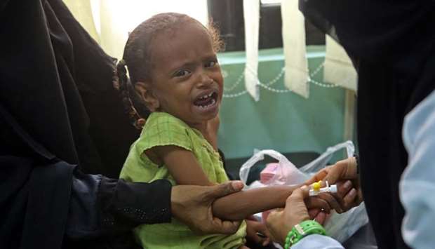 A Yemeni child, who is suspected of being infected with cholera, cries at a hospital in the Yemeni coastal city of Hodeidah on November 5, 2017.
